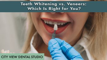 Brighten your smile with teeth whitening or veneers. Learn the difference and find the best cosmetic solution for your goals at City View Dental Studio in Albuquerque, NM.
