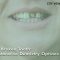 Fixing a Broken Tooth: Your Restorative Dentistry Options (featured image)