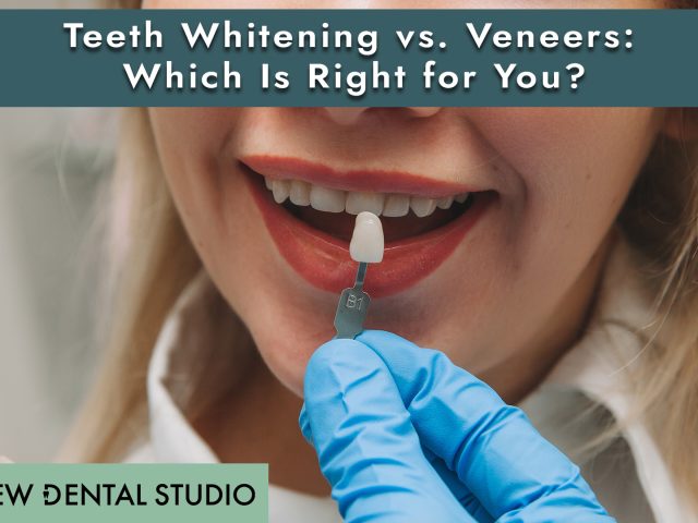 Teeth Whitening vs. Veneers: Which Is Right for You? (featured image)