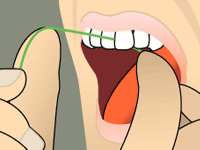 Floss is held tightly and curved into a C-shape against a tooth under the gum line.
